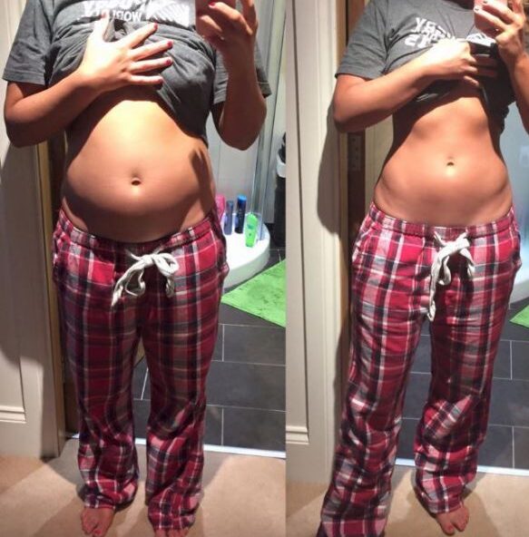 Antes y después Sofía