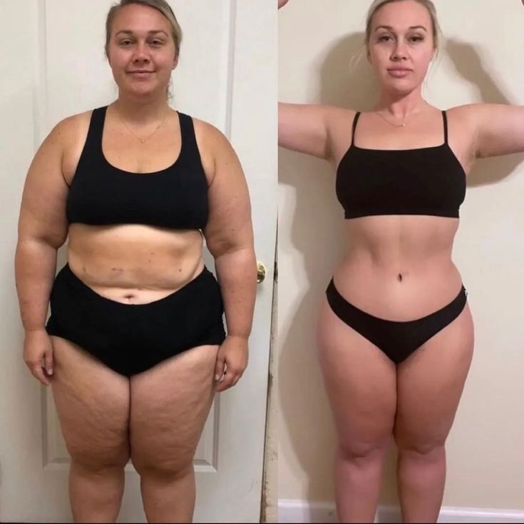 Antes y después Patricia