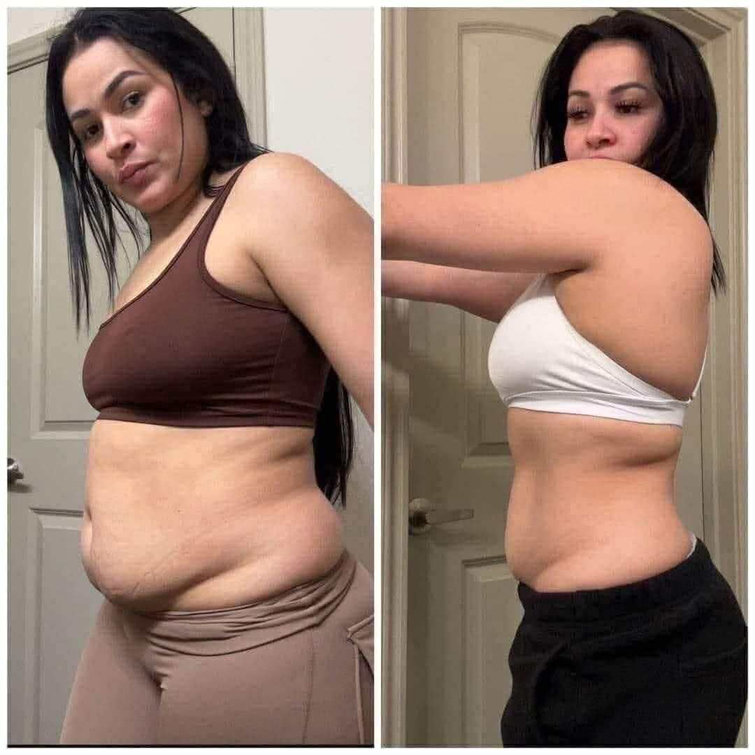 Antes y después Valeria